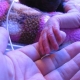 World Prematurity Awarenes Day – Our Miracle Preemie